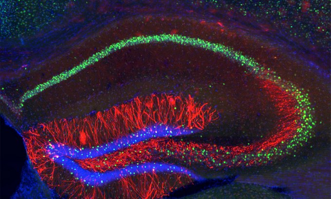 Ερευνητές του MIT ανακαλύπτουν την τοποθεσία των αναμνήσεων στον εγκέφαλο