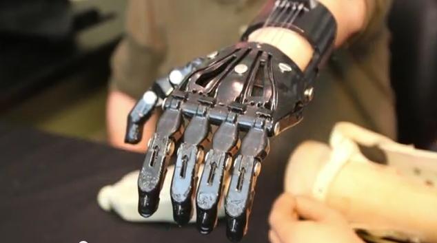 Άνδρας συγκρίνει προσθετικό χέρι αξίας 42.000 δολ. με 3D τυπωμένο μοντέλο αξίας 50 δολαρίων