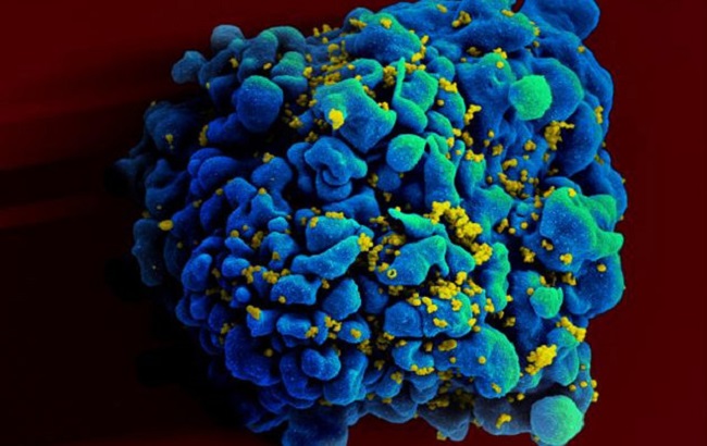 Ερευνητές "διαγράφουν" τελείως τον ιό HIV από τα ανθρώπινα κύτταρα