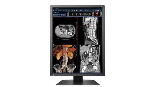 Περισσότερες πληροφορίες για "EIZO RadiForce RX250 (21.3"/Δεν υποστηρίζεται)"