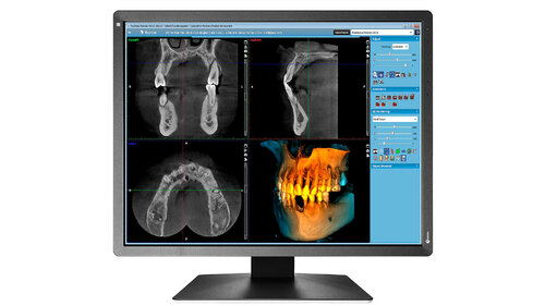 Περισσότερες πληροφορίες για "EIZO RadiForce MX216-SB (21")"