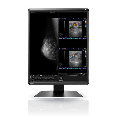 Περισσότερες πληροφορίες για "EIZO RadiForce RX560 (21.3"/Δεν υποστηρίζεται)"