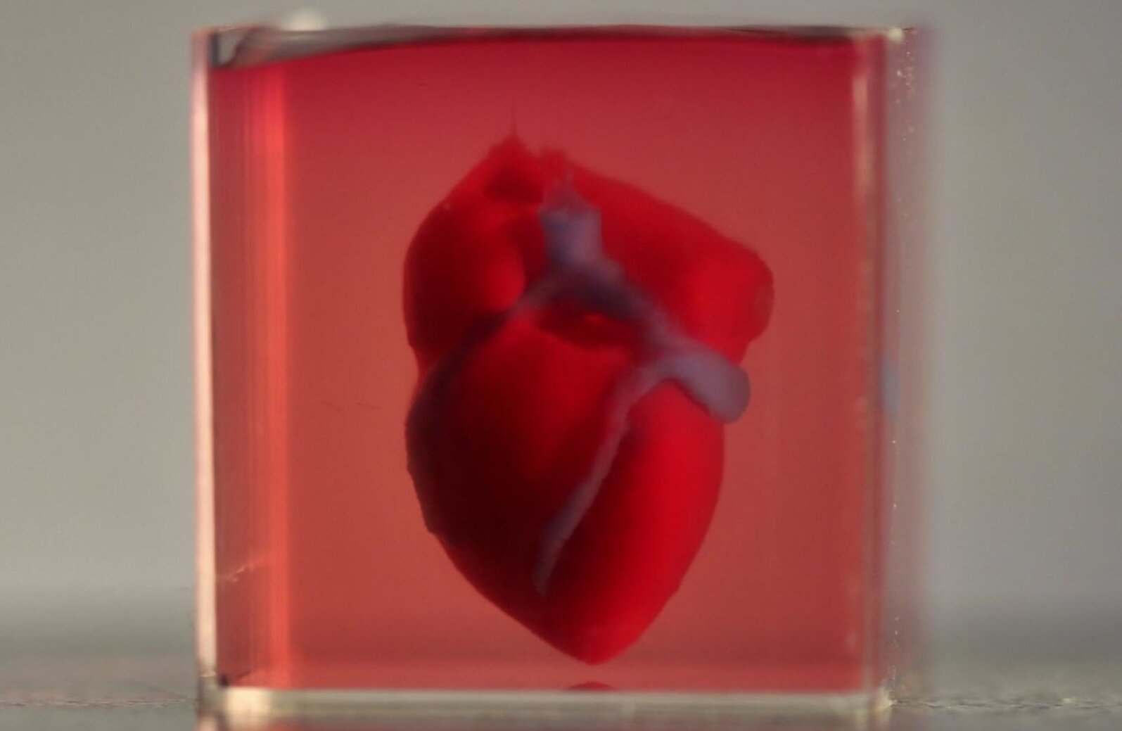 Επιστήμονες κατάφεραν να εκτυπώσουν μία τρισδιάστατη καρδιά χρησιμοποιώντας κύτταρα ασθενή
