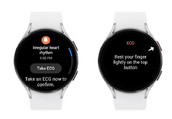 Το Galaxy Watch της Samsung θα μπορεί σύντομα να ειδοποιεί τους χρήστες για ακανόνιστους καρδιακούς ρυθμούς